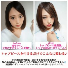 画像3: 幅広つむじタイプ！ロングタイプ☆ショートタイプ☆2タイプ☆トップピース【全5色】 (3)